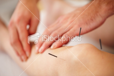stock-photo-15132740-woman-treated-with-acupuncture-jpg
